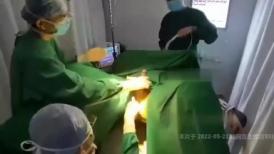 有谁知道这是要做什么手术 术前被医生助手玩到射精再潮喷 这个女助手的技术太好了 看来经常帮撸