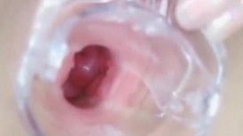 少女扩阴【子宫秀】，扩阴自慰，叫爸爸，把精液全部射进少女子宫吧萝莉内窥镜看b 无码